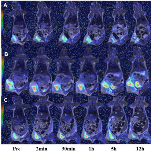 Figure 6 The fusion images of T2WI and T2* map for 4T1 tumor model, acquired at 0, 2 min, 30 min, 1 h, 5 h and 12 h after the mice were intravenously injected with the CuFeSe2-PEG-FA nanoparticles (A), CuFeSe2 nanoparticles (B) and 5% glucose solution (C) respectively.