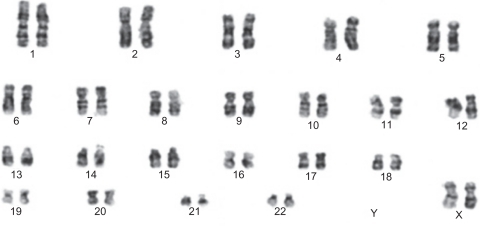 Figure 7 Markers of flow cytometric analysis performed on unrestricted somatic stem cells. Before beginning the experiments, karyotype analysis was performed on unrestricted somatic stem cells of passage 2, revealing a normal 44, XX karyotype. After 48 passages, these cells were subjected to karyotype analysis once again, and they were shown to have a normal chromosome karyotype of 44, XX (see Figure 8).