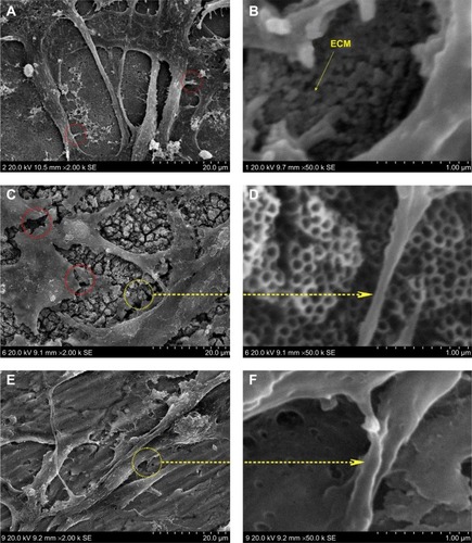 Figure 3 High magnification scanning electron microscopic images of U87 cells.Notes: (A) U87 cells cultured on 20 nm nanotubes. The red circles indicate the tiny filiform pseudopodia. (B) The ECM component is deposited on the 20 nm nanotubes. (C) U87 cells cultured on 120 nm nanotubes. The red circles indicate the fracture of the cells. (D) Cell extensions protrude to the tube walls. (E) U87 cells cultured on smooth titanium substrate. (F) Microfilaments and pseudopodia stretched on the surface of smooth titanium.Abbreviation: ECM, extracellular matrix.