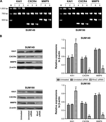 Figure 3 Expression of KAI1, CXCR4, and MMP9 in mRNA (A) and protein (B) levels after siRNA transfection.