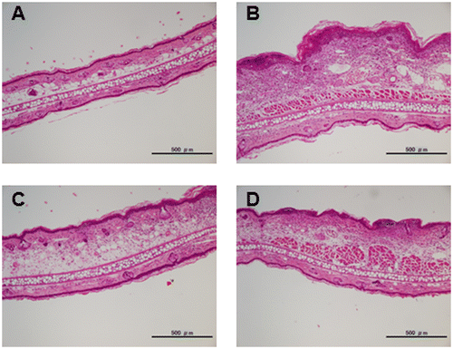 Fig. 2. Histopathological images of DNFB-challenged mouse ears.