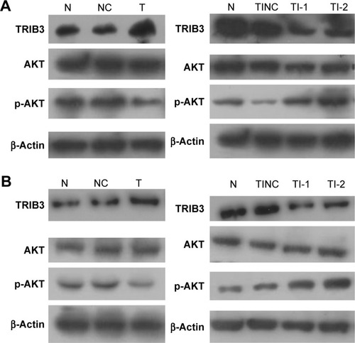 Figure 6 AKT and p-AKT levels in (A) ISK cells and (B) AN3CA cells were examined by Western blot. N, normal control group; NC: TRIB3 overexpression negative control group; T: TRIB3 overexpression group; TI: TRIB3 inhibitor group; TI-1: TRIB3-shRNA plasmid 1 group; TI-2: TRIB3-shRNA plasmid 2 group; TINC: TRIB3-shRNA inhibitor negative control group.