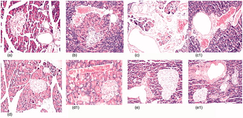 Figure 3. (a) Photomicrograph of pancreas tissue section of control rats showing no histopathological alteration and the normal histological structure of the islands of Langerhans cells as endocrine portion as well as the acini and duct system as exocrine portion (H&Ex40). (b) Photomicrograph of pancreatic tissue section of diabetic rats showing atrophy in most of the islands of Langerhans cells with pyknosis of their nuclei and congestion in the blood vessels (H&Ex40). (c) Photomicrograph of pancreatic tissue section of diabetic nephroapathy rats showing edema with few inflammatory cells infiltration in the interlobular stroma (H&Ex40). (c1) It shows cystic dilatation in the ducts associated with congestion in the blood vessels (H&Ex40). (d, d1) Photomicrograph of pancreatic tissue section of diabetic rats treated with MSCs showing exocrine acini and fatty change in the lining epithelium with congestion in the blood vessels (H&Ex40). (e, e1) Photomicrograph of pancreatic tissue section of diabetic nephroapathy rats treated with MSCs showing no histopathological alteration in the islands of Langerhans cells, while the ducts showing periductal fibrosis.
