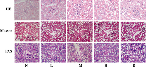 Figure 3 Hematoxylin and eosin (HE), Masson trichome, and periodic acid-Schiff (PAS) staining of kidney tissues from the five groups at study completion (week-32).N :normal control; L: Low-dose TCM; M: Medium-dose TCM; H: High-dose TCM; D: DKD. Scale bars show magnification.