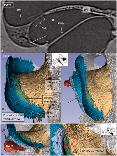 Figure 3. A: SR-PCI section of a left ear showing RM, SL (arrows), and RWM at the cul-de-sac of the endolymphatic space. There is an increased contrast (arrows) of the inferior region of the SL facing the ST. B: SV view of the 3D reconstructed tissues in the same cochlea. The basal end of the BM is seen together with the SL (blue) and OSL (yellow). C: Slightly angled view demonstrates the SSL (arrow). D: Postero-inferior view shows the BM in the SV and the external surface of the RWM with surrounding SSL. E: Infero-lateral view of the basal end of the BM where it joins with the SSL (*), SL, and OSL (encircled). (For abbreviations, see legend to Figure 1).