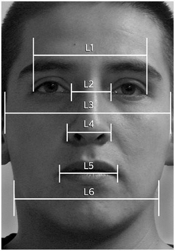 Figure 1. Example of the lines used for facial measurements of facial fluctuating asymmetry.
