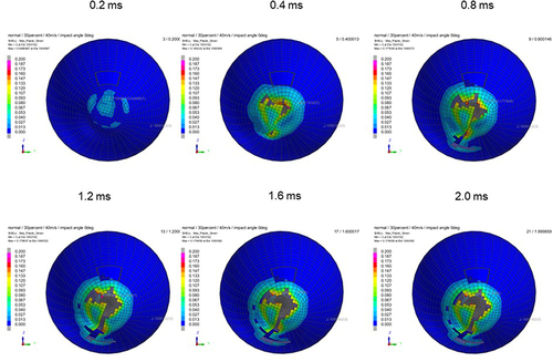 Figure 18 Sequential strain strength response of ocular surface of model eye upon airbag impact in straight position at 40 m/s with adhesion strength of scleral flap of 30%, shown at 0.4-ms intervals after 0.2 ms. Strain strength change is displayed in color as presented in the color bar scale (Figure 2).