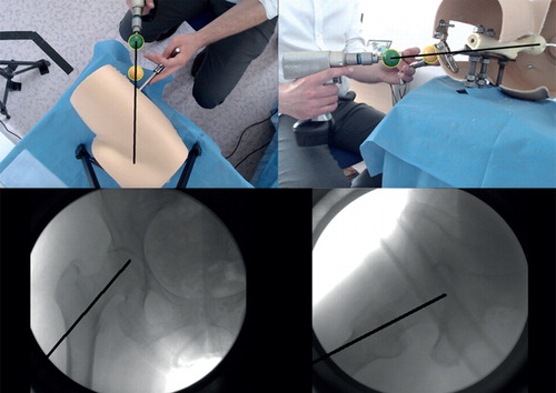 Figure 3. A surgeon using FluoroSim with the phantom limb, surgical equipment and the imaging system.