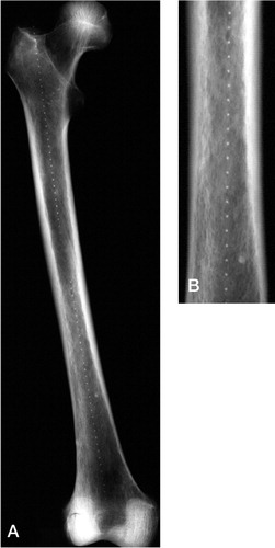 Figure 5. A Human femur covered with markers at 5-mm intervals. B. This cut-out at higher magnification clearly illustrates the difference in radio-opacity between the markers and the bone.