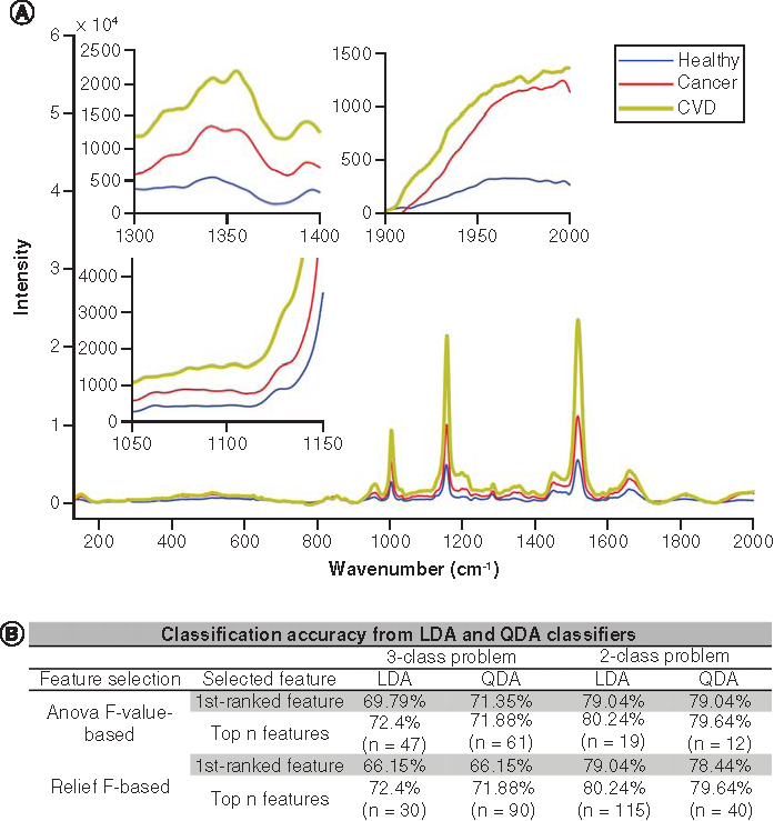 Figure 2. nanoSERS discrimination between healthy, CVD and hematological malignancies using LDA and QDA. (A) Mean nanoSERS spectra of the three cohorts with insets representing feature selections of LDA and QDA. (B) Classification accuracies from LDA and QDA.CVD: Cardiovascular disease; LDA: Linear discriminant analyses; QDA: Quadratic discriminant analyses.