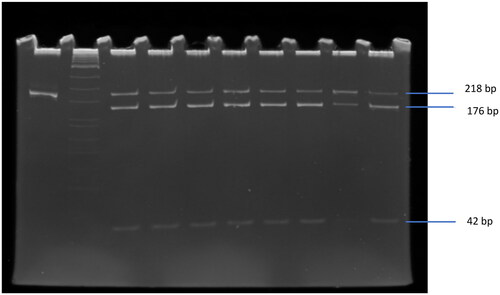 Figure 1. PTPN22 gene variant C1858T was analysed by PCR-RFLP and visualized by ethidium bromide stained polyacrylamide gel that were line 1 of PCR product without cutting and line 2–9 of samples with cutting by RsaI enzyme. M: marker (One STEP Marker 9, Wako, Japan).