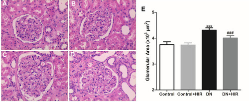 Figure 2 Effect of HIR on renal pathological changes in DN rats. (A–E) H&E staining was used to assess the changes of renal pathological in rat of control (A), control + HIR (B), DN (C), and DN + HIR (D) groups, and glomerular area was also detected and compared in different groups (E). Seven rats per group and each rat measures at least 10 glomeruli area. ***Indicates P < 0.001 vs control group, and ###indicates P < 0.001 vs DN group.