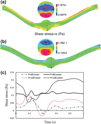 Figure 6. The lumen shear stress- rz contours of aneurysmal carotid artery under pulsatile flow with a stretch ratio of 1.3 and lumen pressure of: (a) mmHg. (b)  mmHg.