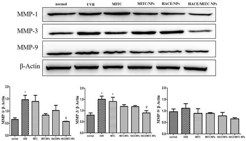 Figure 10. Western blotting was used to evaluate the UVB-induced reduction of photoaging of the modified isothiocyanate liposomes when drugs stored 10 days. (A) Protein expression of MMP-1; (B) protein expression of MMP-3; (C) protein expression of MMP-9. Data are expressed as mean ± SEM from three independent experiments (n = 3, *compared with the normal group, *p < .05; #compared to the UVB group, #p < .05).