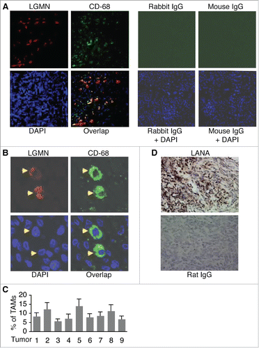 Figure 1. Detection of TAMs in KS tumor sections by immuno-fluorescence antibody staining (IFA). A, representative image of KS tumor sections co-stained with a rabbit anti-human LGMN polyclonal antibody and a mouse anti-human CD-68 monoclonal antibody, which were revealed with an Alexa Fluor®-633 conjugated goat anti-rabbit secondary antibody and a FITC-conjugated goat anti-mouse secondary antibody respectively. Rabbit IgG and mouse IgG were used as negative controls, and DAPI was used for nuclear staining of all cells. LGMN and CD-68 positive cells were imaged under a confocal microscope with a 10x objective. B, LGMN and CD-68 positive cells described in (A)that were imaged under a confocal microscope with a 40x oil objective. C, percentage (%) of TAMs in KS tumors. The numbers of LGMN+/CD-68+ cells and total cells per field under 40x oil objective from 4 fields per tumor were counted and used for the calculation of % of TAMs. D, representative image of KS tumor sections stained with a rat monoclonal antibody to KSHV latent protein LANA, which was revealed with a biotinylated secondary antibody and streptavidin-horseradish peroxidase, and DAB (3,3′-diaminobenzidine) detection system from Biolegend (San Diego, California, USA). Rat IgG was used as a negative control. Images were captured under a microscope (Carl Zeiss, Inc., Thornwood, NY).