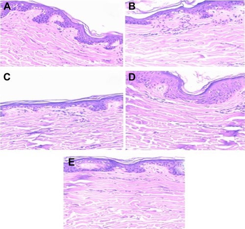 Figure 6 Phytomicrographs of skin after 8 hours of skin permeation (tenfold optical zoom).Notes: Untreated skin (A); skin treated with LP20 (B), LP80 (C), SP80 (D), and SP20 (E) nanoemulsions.Abbreviations: LP20, soybean lecithin and polysorbate 20; LP80, soybean lecithin and polysorbate 80; SP20, sorbitan monooleate and polysorbate 20; SP80, sorbitan monooleate and polysorbate 80.