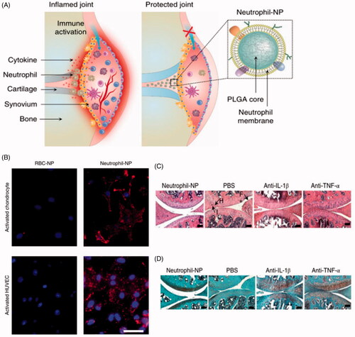 Figure 4. (A) Schematic representation of neutrophil membrane-camouflaged nanoparticles (NPs) for suppressing synovial inflammation and ameliorating joint destruction in inflammatory arthritis. (B) Fluorescent images of chondrocytes and human umbilical vein endothelial cells (HUVECs) after incubation with neutrophil-NPs or red blood cell (RBC)-NPs. Nuclei appear blue; nanoparticles, red. Scale bar, 50 μm. (C–D) Representative micrographs of knee sections from mice treated with neutrophil-NPs or phosphate-buffered saline (PBS), then stained with (C) H&E staining or (D) safranin-O. Some sections were also immunostained with antibody against IL-1β or TNF-α. Scale bars, 100 μm. F, synovial membrane fibrillation; H, synovium hyperplasia; I, immune cell infiltration; RBC-NP, nanoparticle coated with red blood cell membrane; neutrophil-NP, nanoparticle coated with neutrophil membrane; PLGA, poly(lactic-co-glycolic acid) (Zhang et al., Citation2018). Copyright 2018, Springer Nature.