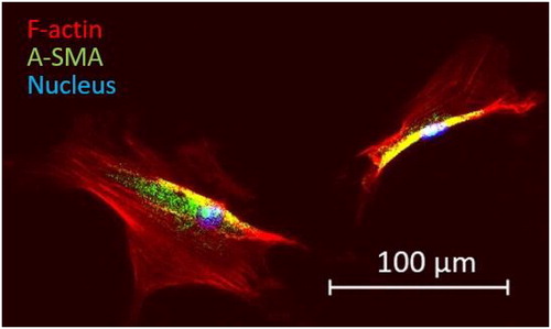 Figure 2. Images of the cell cytoskeleton and nucleus obtained with fluorescence microscopy, F-actin is stained in red (Objective Plan-Neofluar x10).