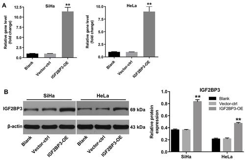 Figure 3 IGF2BP3 is overexpressed in cervical cancer cells. SiHa and HeLa cells were infected with IGF2BP3-OE plasmids, respectively. (A) The level of IGF2BP3 in SiHa and HeLa cells was analyzed by RT-qPCR. (B) The expression of IGF2BP3 in SiHa and HeLa cells were analyzed by Western blotting. **P < 0.01, compared with the vector-ctrl group.