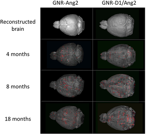 Figure 5 Reconstruction of the brains of transgenic animals (without the skull) of different ages (4, 8, and 18 months) treated with GNR-Ang2 or GNR-D1/Ang2, according to the results obtained by CT. The reconstructed brain is shown in the upper panel with 100% density and in the lower images with 50% attenuation, which allowed us to observe the content of objects detected within the brains of the animals (red-marked areas are referred to as “objects”).