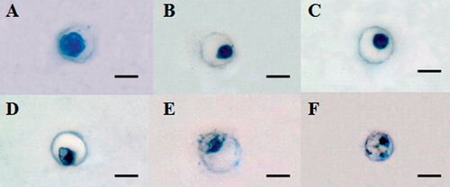 Figure 4.  Effects of 3D collagen gel culture. Histological appearance of cells at: week 0 (A), week 1 (B), week 2 (C), week 3 (D), week 4 (E), and week 5 (F). Representative sections were stained with toluidine blue. Scale bars: 10 µm.