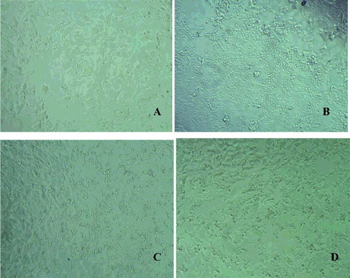 Figure 4. Microphotographs of neuroblastoma SH-SY5Y cells: Control untreated cells (A); cells treated with H2O2 alone (B); cells pretreated with QR-NP1 and QR-NP2 before H2O2-addition (C and D, respectively).