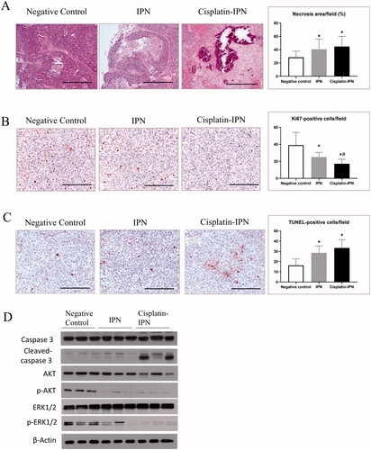 Figure 3. IPN hydrogel based TPVE suppressed tumor proliferation. (A) The tumor histology was detected by H&E staining. Bar = 400 μm. The necrosis area percentages in tumors were compared from each group as shown in the bar chart. (B) The proliferation levels were detected by anti-Ki67 staining. Bar = 200 μm. The Ki67 positive cells per field in the tumors were compared from each group as shown in the bar chart. (C) The apoptosis levels were detected by TUNEL assay. Bar = 200 μm. The TUNEL-positive cells per field in tumors were compared from each group as shown in the bar chart. (D) The expressions of intra-tumor caspase 3, cleaved caspase 3, Akt, phosphorylated Akt, ERK1/2, and phosphorylated ERK1/2 from each group were detected by Western Blot. (∗p < .05 differences between treatment group and negative control group; #p < .05 differences between treatment groups).