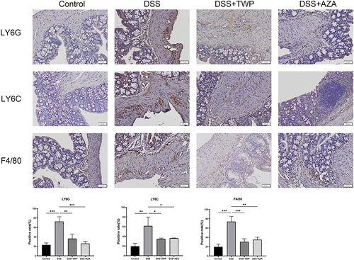 Figure 9 Expression of Ly6G, Ly6C and F4/80 in mouse colon. Scale bar: 50μm. Each data represents at least three independent experiments. *P<0.05, **P<0.01, ***P<0.001.