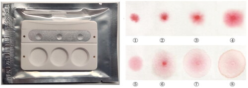 Figure 1. Urine Congo red kit test.