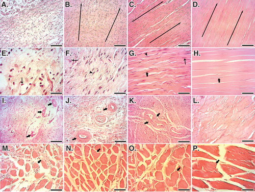 Figure 11. Histopathology sections of the injured and normal tendons at 60 days post-injury (DPI). A to D. Longitudinal sections of the tendons, scale bar = 50 µm. E to H. Longitudinal sections of tendons, scale bar = 12.5 µm. I to L. Transverse sections of the tendons, scale bar = 50 µm. M to P. Transverse sections of gastroc-soleus muscle, scale bar = 50 µm. A, E, I and M are ICTs (no implant); B, F, J and N are injured treated tendons with collagen implant (ITTCs); C, G, K and O are ITTC-Ps and D, H, L and P are normal contralateral healthy tendons (NCTs), for comparison. At 60 DPI, no tendinous tissue was formed in the ICTs (A) so that the density of the collagenous matrix was low (A) and the collagen-like fibers were randomly orientated at different directions (A). The cells in these tendons were immature tenoblasts (E, thin arrow) and no signs of cell alignment was seen (E). The newly developed vessels in these tendons were small and immature (I, arrows) and the muscle fibrosis and atrophy was obvious in this group (M, arrow shows a muscle fiber). In contrast to the ICTs, the collagen fibers formed in an aligned manner in the ITTCs and ITTC-Ps, (B and C, long arrows show the direction of the collagen fibers), the cells were mostly mature tenoblasts (arrow head) and tenocytes (thick arrow) and larger and mature vessels were regenerated in the injured area (J and K, arrows). The muscle fibrosis and atrophy were less than ICTs (N and O, arrows show muscle fibers). Compared to the ITTCs, the ITTC-Ps showed higher degree of collagen and cellular maturation and alignment, larger and thicker vessels and less muscle fibrosis and atrophy. Color staining = H&E.