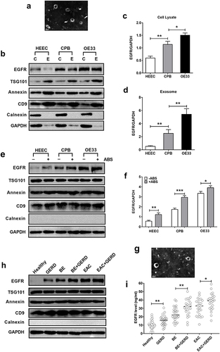 Figure 1 ABS improve the exosome-delivered EGFR of normal esophageal epithelial Cell, BE cell, and EAC cell. (a) A cell line-derived exosome representative electron microscopy picture is shown. Scale bar, 100 nm. (b) Western blot analysis of EGFR expression in cell lines and their corresponding exosomes is shown. (c) cell lysate, (e) exosome. (c and d) The statistical analysis of relative gray values of EGFR is shown. (e) Western blot analysis of EGFR expression in exosomes from HEEC, CPB, and OE33 cell lines with or without ABS cocktail (100 μM) treatment for 36 h. (f) The statistical analysis of relative gray values of EGFR is shown. (g) A serum-derived exosome representative electron microscopy picture is shown. Scale bar, 100 nm. (h) A representative picture of Western blot analysis of EGFR expression in serum-derived exosomes from healthy persons and patients is shown. (i) The ELISA analysis of EGFR in serum-derived exosomes from healthy persons and patients (n=25) was performed. Data are represented as the mean±SD (n=3), and 3 independent experiments were performed. *p< 0.05, **p< 0.01, ***p<0.001, compared with control or between two groups.