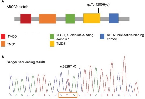 Figure 2 ABCC9 protein structure and Sanger sequencing results.Notes: (A) ABCC9 protein structure: mutation is located on TMD2 domain. Mutations at this point result in gain of function in the KATP channel resulting in the opening of the potassium channel. The arrow indicates the novel variant that was present in the patient. (B) Sanger sequencing results: The box frames the affected codon and the arrow indicates the heterozygous state of the identified variant.