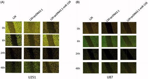 Figure 3. Scratch assay results of (A) U251 cells and (B) U87 cells. L2K group: Blank control group only treated with Lipofectamine 2000; L2K + pcDNA3.1 group: control group treated with Lipofectamine 2000 and vector pcDNA3.1; L2K + pcDNA3.1-miR-126 group: experimental group treated with Lipofectamine 2000 and miR-126 expression vector.