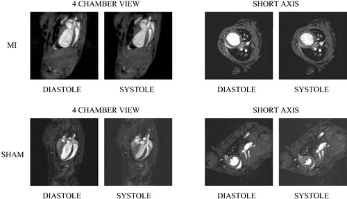 Figure 2 MRI images of mouse hearts 4 weeks after experimentally induced myocardial infarction(MI) or sham operation (SHAM).