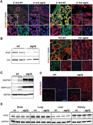 Figure 1. Autophagy is specifically inhibited in atg7Δ mice muscles. (a) Myosin heavy chain (MYH) (red) and ATG7 (green) immunostaining of abdominal muscle in transverse sections of WT and atg7Δ embryos at E14.5 (scale bar: 50 µm) and of hind limb muscle at E18.5 (scale bar: 25 µm). DAPI is used as a nuclear stain (blue). (b) Left panel: representative immunoblotting analysis of ATG7 and VCL (vinculin) as a loading control in muscle (gastrocnemius, GC) protein extracts from WT and atg7Δ mice at P21. Right panel: representative immunostaining of MYH (red) and ATG7 (green) in WT and atg7Δ muscle sections at P21. DAPI is used as a nuclear stain (blue) (scale bar: 25 µm). (c) Representative immunoblotting analysis of autophagy-related proteins SQSTM1, MAP1LC3 and GAPDH as a loading control in GC protein extracts. (d) Representative SQSTM1 immunostaining (red) of tibialis anterior (TA) sections. DAPI is used for nuclear staining (blue) (scale bar: 100 μm). (e) Representative immunoblotting analysis of ATG7 and GAPDH as a loading control in other organs.