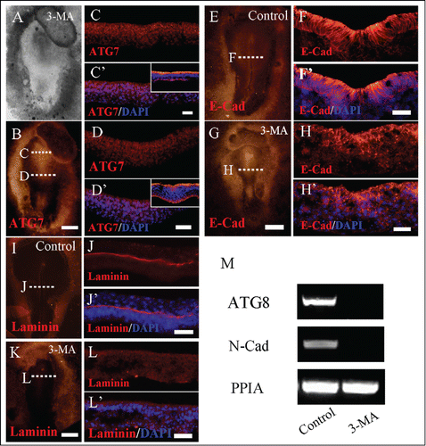 Figure 5. 3-MA treatment leads to the alteration of adhension molecule expression in gastrula embryo. Immunofluorescent staining against Atg7, E-Cadherin and Laminin were performed on the control and 3-MA-treated HH5 chick embryos, so did the RT-PCR assay of N-Cadherin expression. (A and B) The bright-filed images (A) and Atg7 immunofluorescent images (B) of the embryo respectively treated by 3-MA at 33 hour. C-C′: The transverse sections of Atg7 expression (C) and Atg7 expression + DAPI staining (C′) respectively at the level indicated by dotted line C in B panel, the small panel in C′ is control section. D-D′: The transverse sections of Atg7 expression (D) and Atg7 expression + DAPI staining (D′) respectively at the level indicated by dotted line D in B panel, the small panel in D′ is control section. (E and G) Immunofluorescent staining against E-Cadherin on the whole-mount control (E) and 3-MA-treated (G) HH4 chick embryos respectively. F, F′: The transverse sections at the level at the middle primitive streak as indicated by white dotted line in E. F is the E-Cadherin only; F′ is the E-Cadherin + DAPI staining. H, H′: The transverse sections at the level at the middle primitive streak as indicated by white dotted line in G. H is the E-Cadherin only; H′ is the E-Cadherin + DAPI staining. (I and K) Immunofluorescent staining against laminin on the whole-mount control (I) and 3-MA-treated (K) HH4 chick embryos respectively. J, J′: The transverse sections at the level at the middle primitive streak as indicated by white dotted line in I. J is the laminin only; J′ is the Laminin + DAPI staining. L, L′: The transverse sections at the level at the middle primitive streak as indicated by white dotted line in K. L is the Laminin only; L′ is the Laminin + DAPI staining. (M) RT-PCR showing Atg8 and N-Cadherin expression in the control and 3-MA-treated embryos. Abbreviations: E-Cad, E-Cadherin; N-Cad, N-Cadherin. Scale bars = 500 μm in A and B, 70 μm in C and C′, 40 μm in D and D′, 500 μm in E and G, 30 μm in F and F′, 600 μm in I and K and 30 μm in H and H′.