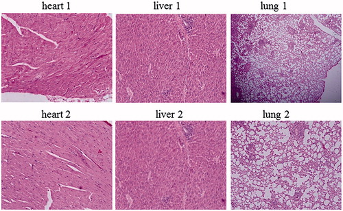 Figure 7. Different morphological patterns of heart, liver and lung, (1) before (as references) and (2) after injection of ZnO nanofluid.