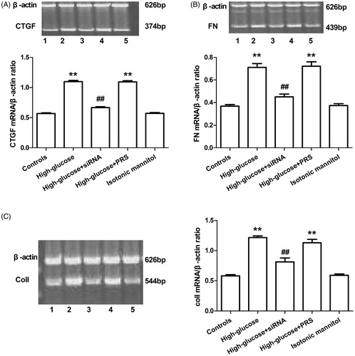 Figure 5. The effect of PRS-CTGF-siRNA on high glucose-induced CTGF, FN and CoI1 mRNA expression in HKCs. The CTGF (A), FN (B) and CoI1 (C) mRNA expression in HKCs cultured under 5.5 mm glucose (controls), 30 mm glucose (high glucose), high glucose + siRNA, high glucose + PRS and isotonic mannitol for 48 h. The mRNA expression determined by RT-PCR; **p < 0.01 versus controls, ##p < 0.01 versus high glucose group.