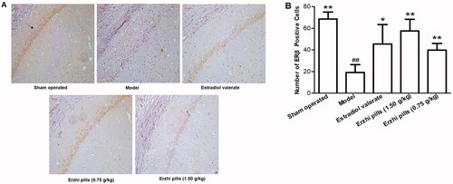 Figure 6. Effects of Erzhi pills on the expression of ERβ in hippocampus of AD model rats induced by ovariectomy as well as d-galactose and Aβ1–40 injection. (A) The effect of Erzhi pills on ERβ expression in hippocampus CA1 area of AD rats (IHC, 200×). (B) The effect of Erzhi pills on the number of ERβ positive cells in hippocampus CA1 area of AD rats. ##p < 0.01, vs. Sham-operated group; *p < 0.05, **p < 0.01, vs. model group. Mean ± SD, n = 6.