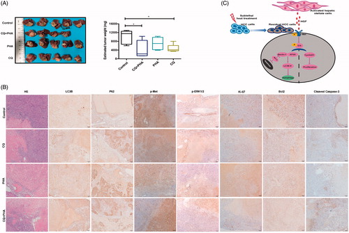 Figure 7. A combination of autophagy inhibitor CQ and c-Met inhibitor (PHA) suppressed tumor progression of residual HCC after incomplete RFA. (A) Tumor size of residual HCC after incomplete RFA was significantly smaller in combined treatment (CQ + PHA) group than that in the other groups (control, CQ, or PHA treatment), except one mouse in combined treatment group died on day 1 after RFA due to intestinal perforation. The box-plots indicate quantification. (B) CQ combined with PHA significantly suppressed autophagy (increased LC3B and P62 expression), ERK1/2 and c-Met phosphorylation and proliferation (decreased Ki-67 expression), and increased apoptosis (low Blc-2 and high cleaved caspases-3) in residual HCC tissues after incomplete RFA. (C) A schematic diagram of activated HSCs promoting tumor progression of heat-treated residual surviving HCC from autophagic survival to proliferation via HGF/c-Met signaling. **, p < .01; *, p < .05, bar = 50 μm/1 mm.