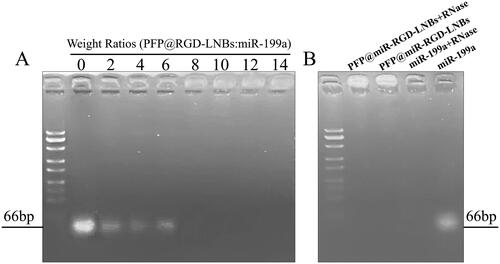 Figure 2. Agarose gel electrophoresis assay. (A) Evaluation of miRNA condensation ability of LNBs using agarose gel retardation experiment: LNBs and miRNA were mixed at various mass ratios, including 0, 2:1, 4:1, 6:1, 8:1, 10:1, 12:1, and 14:1. (B) Assessment of RNase protection capability of LNBs, using electrophoretic mobility analysis of LNBs complexes following RNaseA enzyme digestion.