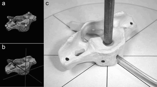 Figure 3. (a) 3D segmented vertebral body with landmarks for point-to-point registration. (b and c) Vertebral body model (c) and 3D segmented model (b) during position error (PE) measurements along the sagittal axis.