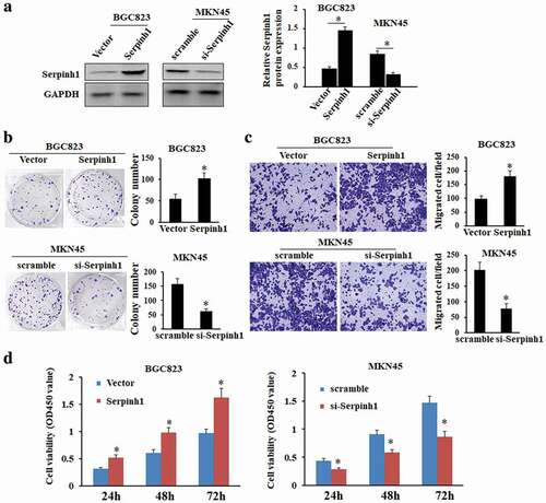 Figure 6. SERPINH1 promotes cell proliferation, colony formation and migration in vitro. (a) The SERPINH1 protein level is increased after overexpression of SERPINH1 in BGC823 cells and decreased after knockdown of SERPINH1 in MKN45 cells. (b) Ectopic expression of SERPINH1 stimulates colony formation in BGC823 cells. Knockdown of SERPINH1 expression inhibits colony formation in MKN45 cells. (c) Ectopic expression of SERPINH1 promotes cell migration in BGC823 cells as demonstrated by transwell assays. Knockdown of SERPINH1 expression inhibits cell migration in MKN45 cells, Original magnification ×100. (d) Ectopic expression of SERPINH1 promotes cell proliferation in BGC823 cells whereas knockdown of SERPINH1 inhibits cell proliferation in MKN45 cells as determined by MTT assays. *P < 0.05.