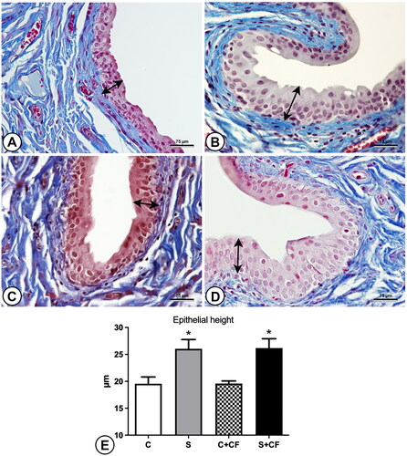 Figure 3. Photomicrographs and graphics representing the epithelial height in the bladder of different groups. The epithelium is marked (in random areas) by double-headed arrows to indicate the differences in epithelial height. (A) Control group (B) Stressed group (C) Control + comfort food group (D) Stressed + comfort food group. Sections were stained using Masson’s trichrome and captured under 600× magnification. (E) Results of epithelial height measurements. Asterisks represents statistical differences (p < 0.0001) between stressed and control animals. Scale bar represents 75 µm.