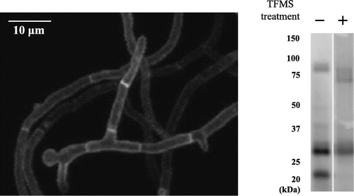 Fig. 4. O-Glycosylated MtlA-EGFP was localized at the cell surface and septa.Note: (A) The MtlA-EGFP-expressing mtlA-disruptant (ΔmtlA::mtlA-EGFP) strain was observed by confocal microscopy. White bar represents 10 μm. (B) Cell extracts of the ΔmtlA::mtlA-EGFP strain treated with and without TFMS were subjected to immunoblot analysis by anti-GFP antibody.