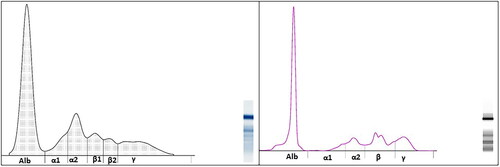 Figure 1. Comparison of the same mink electrophoretic tracings produced using AGE (left) and CZE (right) methods.
