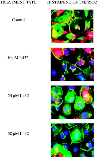 Figure 5. Immunostaining of TMPRSS2 expression pattern in IPEC-J2 cells cultured on polyester membrane inserts treated with inhibitor I-432 at 10, 25 and 50 μM for 48 h. Cell nuclei are stained blue (DAPI), cell membranes are labeled with wheat germ agglutinin (Alexa 488, green). In control samples, TMPRSS2 (Alexa 564, red) is colocalized with wheat germ agglutinin. 48 h long treatment of I-432 induced significant fluorescent signal loss of TMPRSS2. TMPRSS2 occurence was mainly observed around synthesis sites in I-432-treated IPEC-J2 cells. 600× magnification. The scale bar (white) indicates 20 μm (n = 3).