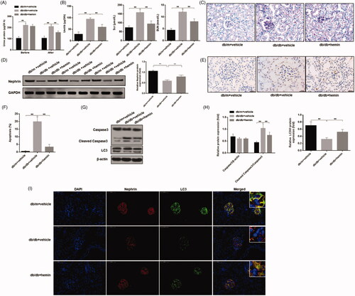 Figure 6. Effects of HO-1 agonist hemin treatment on clinical indications of DN-induced autophagy and apoptosis in podocytes. (A) Evaluation of urinary total protein and urinary albumin showed increased content in DN mice compared to healthy controls, while hemin treatment significantly reduced proteinuria and albuminuria in DN mice. (B) Serum creatinine and urea levels were also significantly reduced by hemin treated DN mice. (C) PAS staining showed glomerular damage in DN mice and it was rescued by hemin treatment. (D) Protein expression analysis revealed that expression of critical protein in renal filtration barrier nephrin was downregulated in DN mice, and hemin treatment significantly increased the neprhin expression and densitometric analysis of protein expression. (E) TUNEL staining showed that hemin treatment significantly reduced apoptotic cells in DN mice. (F) Quantification of apoptotic cells. (G) Protein expression by Western blot. (H) Densitometric analysis of protein expression. (I)Expression and distribution of nephrin and LC3 protein were evaluated by immunofluorescence; the scale indicates 50 μm. (**p < 0.01, *p < 0.05).