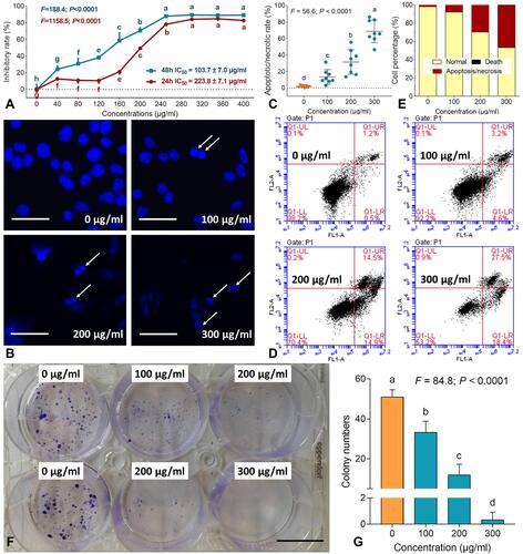 Figure 1 Cell viability (A), DAPI staining (B), apoptotic cell counting for DAPI staining (C), flow cytometry (D), cell percentages of apoptosis (E), clonogenic assay (F) and colony numbers (G) of B16F10 cells with treatments of TF. Data (mean ± SD) points with different letters (a, b, c, d, e, f, g and h) indicate significant difference between each other [Fisher’s least significant difference (LSD), P < 0.05], and the values decrease with the order from a to h. Scale bar = 50 μm.