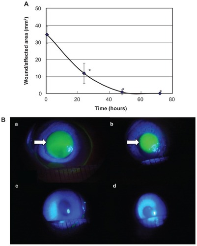 Figure 2 Evaluation of the wound/affected area method (A) and fluorescein staining (B).